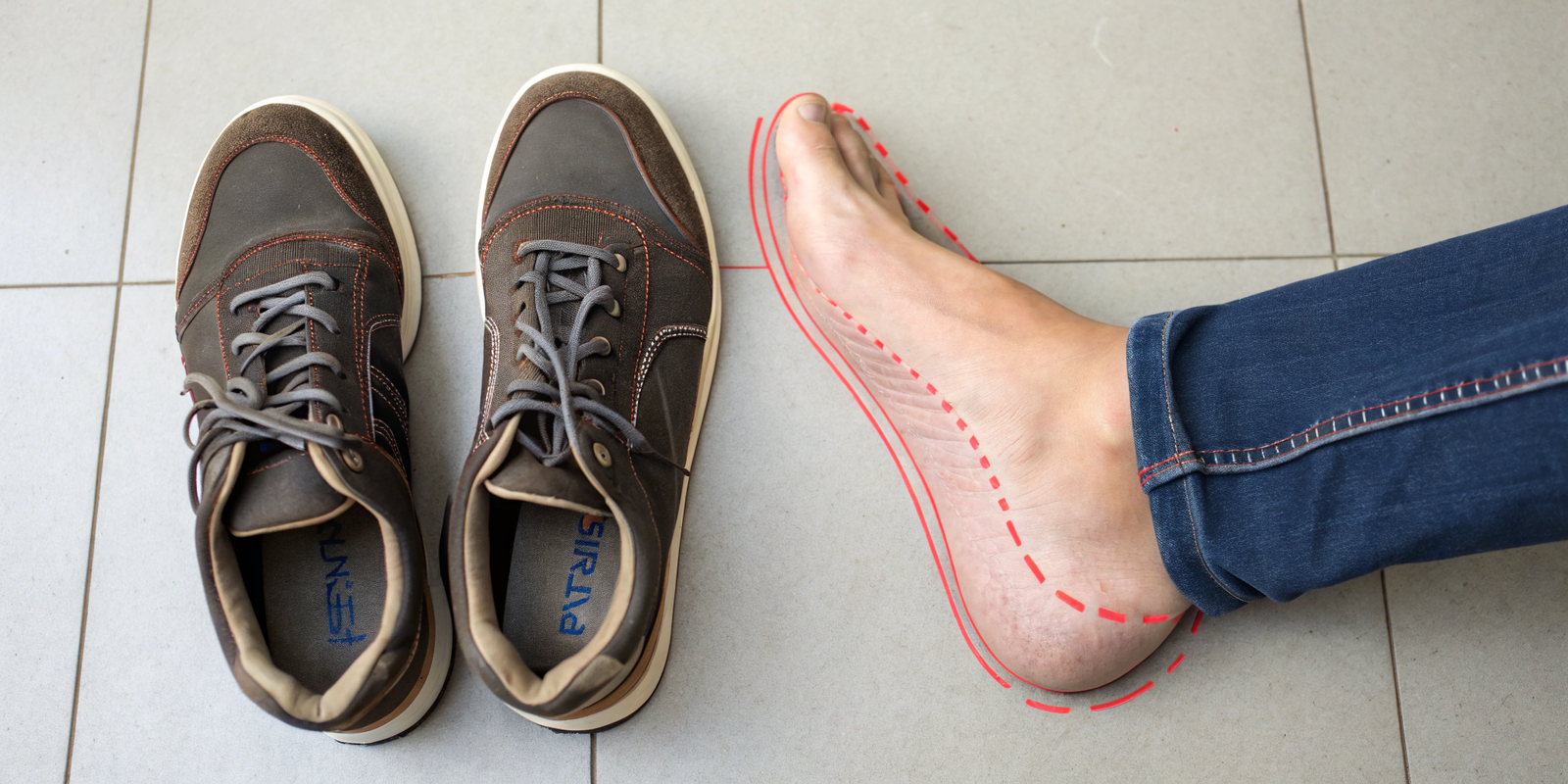are-your-everyday-shoes-sabotaging-your-posture--t